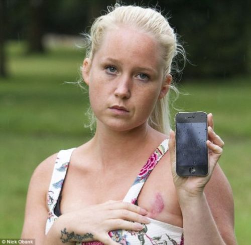 iPhone害人不浅！英国女子抱手机入睡 乳房被灼伤